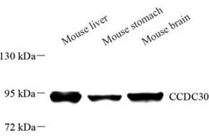 Western blot analysis of CCDC30 (ABIN7073536) at dilution of 1: 500 (CCDC30 Antikörper)