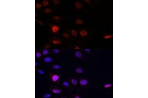 Immunofluorescence analysis of C6 cells using KLHL8 antibody (ABIN7268081) at dilution of 1:100. (KLHL8 Antikörper  (AA 271-620))