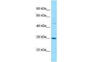 Western Blotting (WB) image for anti-Transforming Growth Factor beta Regulator 1 (TBRG1) (C-Term) antibody (ABIN2788524) (TBRG1 Antikörper  (C-Term))
