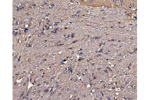 IHC analysis of Gephyrin/GPHN using anti-Gephyrin/GPHN antibody (ABIN7600086). (Gephyrin Antikörper  (AA 148-736))