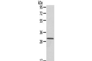 Western Blot analysis of A431 cells using HTATIP2 Polyclonal Antibody at dilution of 1/800 (HIV-1 Tat Interactive Protein 2, 30kDa (HTATIP2) Antikörper)