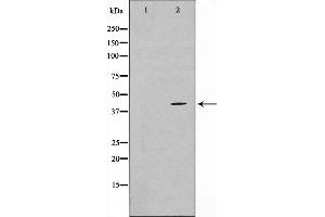 Western blot analysis on COLO205 cell lysate using TBX1 Antibody. (T-Box 1 Antikörper  (C-Term))