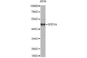 Western blot analysis of extracts of A549 cells, using SPDYA antibody. (SPDYA Antikörper)