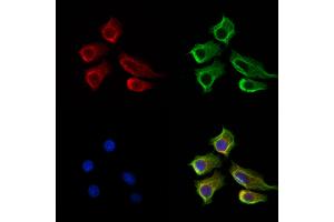 ABIN7094343 and ABIN7098390 staining HepG2 cells by IF/ICC.