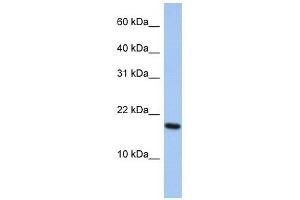 ARL5A antibody used at 1 ug/ml to detect target protein.