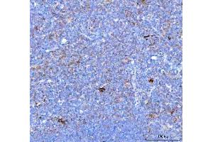 IHC analysis of PDCD1 using anti PDCD1 antibody (ABIN5518784). (PD-1 Antikörper  (N-Term))