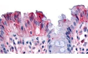 Human Colon, Surface Epithelium (formalin-fixed, paraffin-embedded) stained with MST1R antibody ABIN213539 at 3 ug/ml followed by biotinylated goat anti-rabbit IgG secondary antibody ABIN481713, alkaline phosphatase-streptavidin and chromogen. (MST1R Antikörper  (Internal Region))