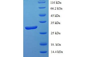 SDS-PAGE (SDS) image for Inhibitor of DNA Binding 1, Dominant Negative Helix-Loop-Helix Protein (ID1) (AA 1-155), (full length) protein (His-SUMO Tag) (ABIN5709693) (ID1 Protein (AA 1-155, full length) (His-SUMO Tag))