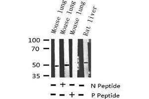 Western blot analysis of Phospho-VASP (Ser157) expression in various lysates (VASP Antikörper  (pSer157))