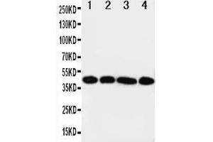 Anti-IL3RA antibody, Western blotting Lane 1: A431 Cell Lysate Lane 2: SMMC Cell Lysate Lane 3: U87 Cell Lysate Lane 4: 293T Cell Lysate