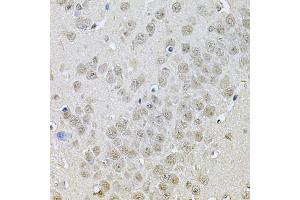 Immunohistochemistry of paraffin-embedded mouse brain using DR1 Antibody (ABIN5975441) at dilution of 1/100 (40x lens). (DR1 Antikörper)