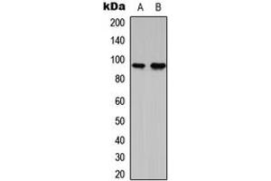 Western blot analysis of G15 expression in RT4 (A), NIH3T3 (B) whole cell lysates. (AGPAT1 Antikörper  (Center))