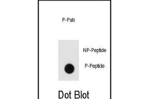 Dot blot analysis of anti-Phospho-Endophilin-pY80 Pab (ABIN650823 and ABIN2839797) on nitrocellulose membrane. (Endophilin (pTyr80) Antikörper)