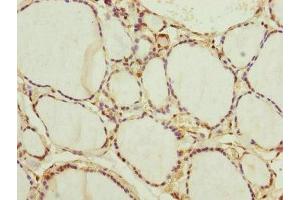 Immunohistochemistry of paraffin-embedded human thyroid tissue using ABIN7165859 at dilution of 1:100 (NEDD1 Antikörper  (AA 411-660))