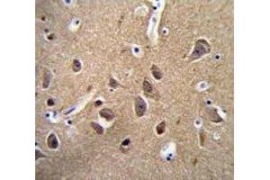 NSE antibody immunohistochemistry analysis in formalin fixed and paraffin embedded human brain tissue.