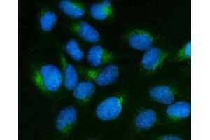 IF analysis of SCG10/STMN2 using anti-SCG10/STMN2 antibody (ABIN7600734).