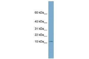 NOLA3 antibody used at 1 ug/ml to detect target protein.