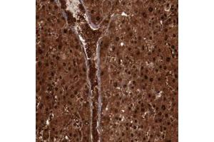 Immunohistochemical staining of human liver with FTSJ1 polyclonal antibody  shows strong nuclear and cytoplasmic positivity in hepatocytes and extracellular positivity in blood vessels .