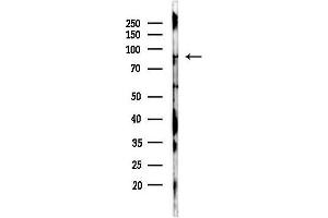 Western blot analysis of lysates from Mouse brain, using eEF2K Antibody at 1/1000 dilution.