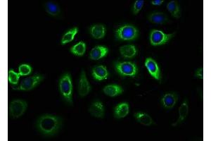 Immunofluorescence staining of A549 cells with ABIN7147047 at 1:33, counter-stained with DAPI. (IGF2R Antikörper  (AA 2328-2491))