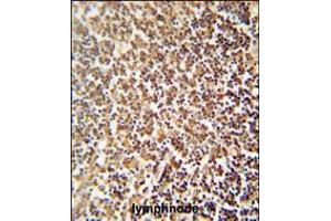 ZNF98 antibody immunohistochemistry analysis in formalin fixed and paraffin embedded human lymphnode followed by peroxidase conjugation of the secondary antibody and DAB staining. (ZNF98 Antikörper  (C-Term))