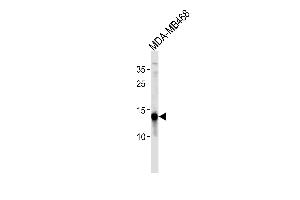 TPD52L3 Antibody (N-term) (ABIN1881899 and ABIN2843497) western blot analysis in MDA-M cell line lysates (35 μg/lane).