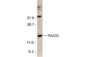 Image no. 2 for anti-CASP2 and RIPK1 Domain Containing Adaptor with Death Domain (CRADD) (C-Term) antibody (ABIN201312) (CRADD Antikörper  (C-Term))