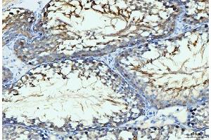 IHC analysis of GIT1 using anti-GIT1 antibody (ABIN7601683). (GIT1 Antikörper  (AA 415-736))