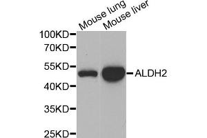 Western blot analysis of extracts of mouse lung and mouse liver  tissues, using ALDH2 antibody.
