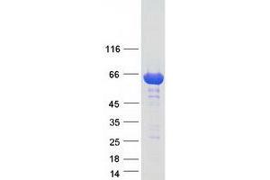 Validation with Western Blot (GGA1 Protein (Transcript Variant 2) (Myc-DYKDDDDK Tag))