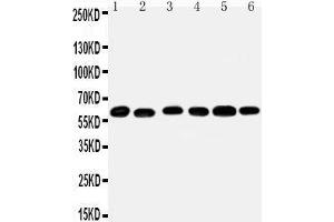 Anti-Monoamine Oxidase B antibody, Western blotting Lane 1: Mouse Liver Tissue Lysate Lane 2: Mouse Lung Tissue Lysate Lane 3: Rat Kidney Tissue Lysate Lane 4: Rat Brain Tissue Lysate Lane 5: Rat Liver Tissue Lysate Lane 6: Rat Lung Tissue Lysate (Monoamine Oxidase B Antikörper  (N-Term))