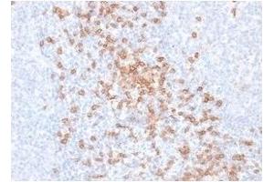 ABIN6383871 to CD8a was successfully used to stain T cells of in human tonsil sections. (Rekombinanter CD8 alpha Antikörper)