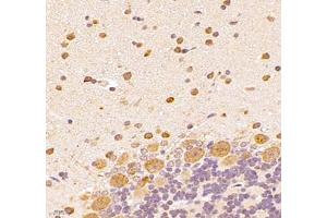 Immunohistochemistry (Paraffin-embedded Sections) (IHC (p)) image for anti-Ubiquinol-Cytochrome C Reductase Complex Chaperone (UQCC) antibody (ABIN7076094)