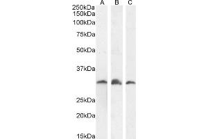 Western Blotting (WB) image for anti-Proteasome (Prosome, Macropain) Inhibitor Subunit 1 (PI31) (PSMF1) (C-Term) antibody (ABIN184933)