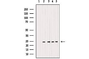 Western blot analysis of extracts from various samples, using RAB14 Antibody. (RAB14 Antikörper  (C-Term))