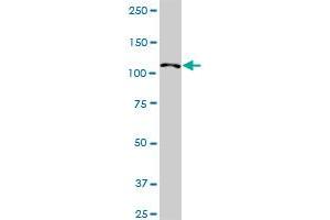 Western Blotting (WB) image for anti-Huntingtin Interacting Protein 1 Related (HIP1R) (AA 1-1068) antibody (ABIN950056)