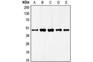 Western blot analysis of GATA4 expression in HepG2 (A), NIH3T3 (B), mouse liver (C), rat liver (D), rat kidney (E) whole cell lysates.