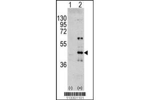 Western blot analysis of MAPK3 using rabbit polyclonal MAPK3 Antibody (Y204) using 293 cell lysates (2 ug/lane) either nontransfected (Lane 1) or transiently transfected with the MAPK3 gene (Lane 2). (ERK1 Antikörper  (AA 182-211))