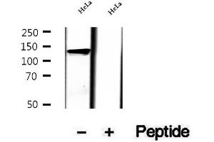 Western blot analysis of extracts of HeLa cells, using LRPPRC antibody. (LRPPRC Antikörper  (Internal Region))