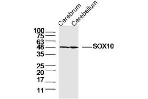 Lane 1: Mouse Cerebrum lysates Lane 2: Mouse Cerebellum lysates probed with SOX10 Polyclonal Antibody, Unconjugated  at 1:300 dilution and 4˚C overnight incubation. (SOX10 Antikörper  (AA 201-300))