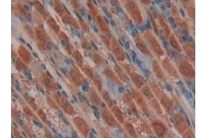 Immunohistochemistry (IHC) image for anti-E3 ubiquitin-protein ligase MIB2 (MIB2) (AA 546-784) antibody (ABIN7439507)