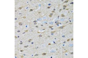 Immunohistochemistry (Paraffin-embedded Sections) (IHC (p)) image for anti-Golgi Membrane Protein 1 (GOLM1) (AA 112-401) antibody (ABIN6141269)