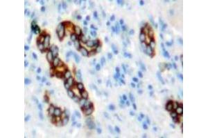 Used in DAB staining on fromalin fixed paraffin-embedded Liver tissue (NUMB Antikörper  (AA 377-642))