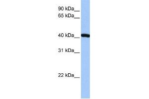 WB Suggested Anti-FTSJ1 Antibody Titration:  0. (FTSJ1 Antikörper  (N-Term))