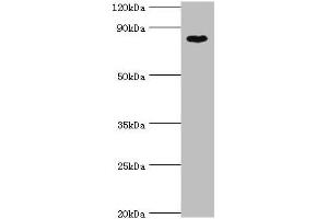 Western blot All lanes: BAP1 antibody at 8 μg/mL + Hela whole cell lysate Secondary Goat polyclonal to rabbit IgG at 1/10000 dilution Predicted band size: 80 kDa Observed band size: 80 kDa (BAP1 Antikörper  (AA 460-729))