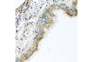 Immunohistochemistry of paraffin-embedded human trachea using ATPIF1 antibody (ABIN5972942) at dilution of 1/100 (40x lens).