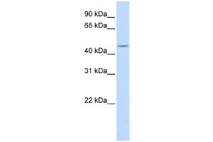 Western Blotting (WB) image for anti-Heat Shock Transcription Factor, Y-Linked 1 (HSFY1) antibody (ABIN2458437)