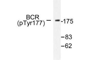 Image no. 1 for anti-Breakpoint Cluster Region (BCR) (pTyr177) antibody (ABIN317974) (BCR Antikörper  (pTyr177))