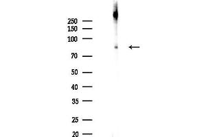 Western blot analysis of lysates from Rat brain, using P2X7 Antibody at 1/1000 dilution.