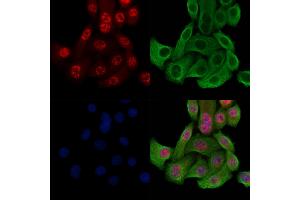 Phospho-Histone H3 (Thr3) Antibody staining Hela cells(heat shock treatment) by IF/ICC.